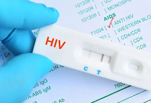 Fake HIV Test Kits Flood Market, FDA Issues Urgent Health Alert